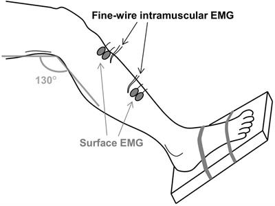 Coherence of the Surface EMG and Common Synaptic Input to Motor Neurons